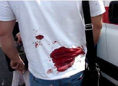 В Мариуполе после засады, устроенной ополченцами, "растерявшиеся" войска укроармии вновь расстреляли мирных жителей В Мариуполе после засады, устроенной ополченцами, "растерявшиеся" войска укроармии вновь расстреляли мирных жителей