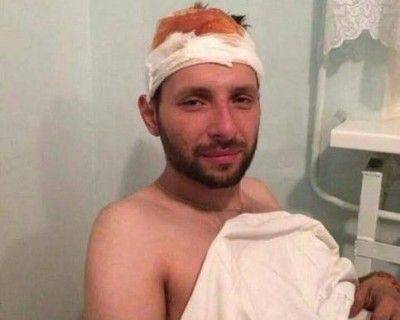 Сотник Парасюк. Ранен в голову, но мозг не задет Сотник Парасюк. Ранен в голову, но мозг не задет