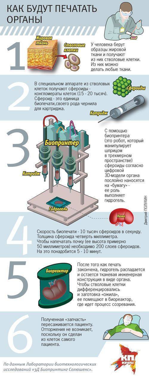 Запасное сердце: версия для печати Запасное сердце: версия для печати
