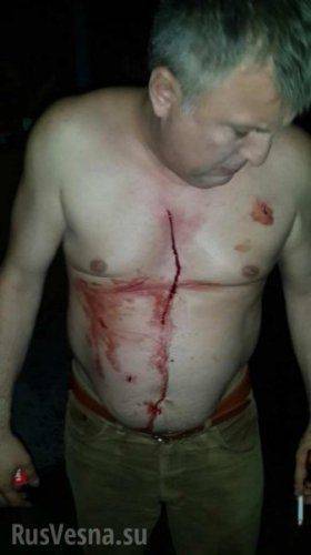 За правду о тысячах убитых под Иловайском совершена попытка убийства режиссера Марка Греся За правду о тысячах убитых под Иловайском совершена попытка убийства режиссера Марка Греся