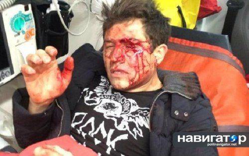 В Киеве избили телеведущего Андрея Джеджулу: врачи зашивают лицо и собирают руку В Киеве избили телеведущего Андрея Джеджулу: врачи зашивают лицо и собирают руку