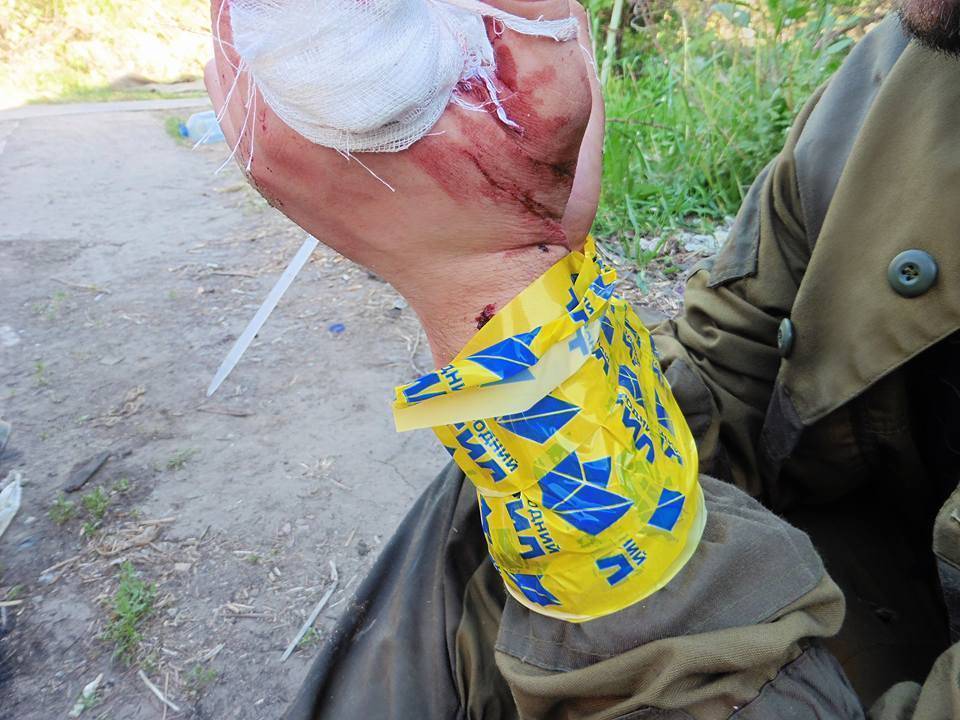 Боевик «Правого сектора» в «Фейсбуке» похвастался фотографиями пленного ополченца с отрезанными пальцами (18+) Боевик «Правого сектора» в «Фейсбуке» похвастался фотографиями пленного ополченца с отрезанными пальцами (18+)