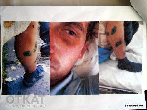 Скандального одесского активиста мать выписала из дома пока он был в АТО Скандального одесского активиста мать выписала из дома пока он был в АТО