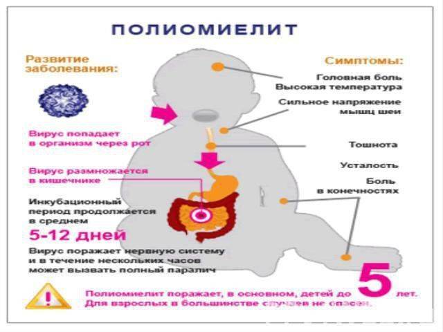 Полиомиелит атакует Украину Полиомиелит атакует Украину