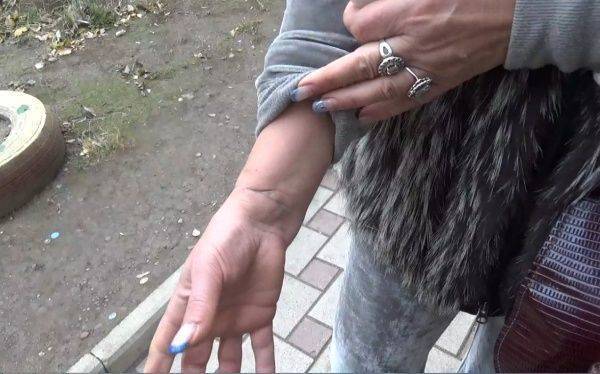 Валентина Швачко: «В меня летел снаряд ВСУ» Валентина Швачко: «В меня летел снаряд ВСУ»