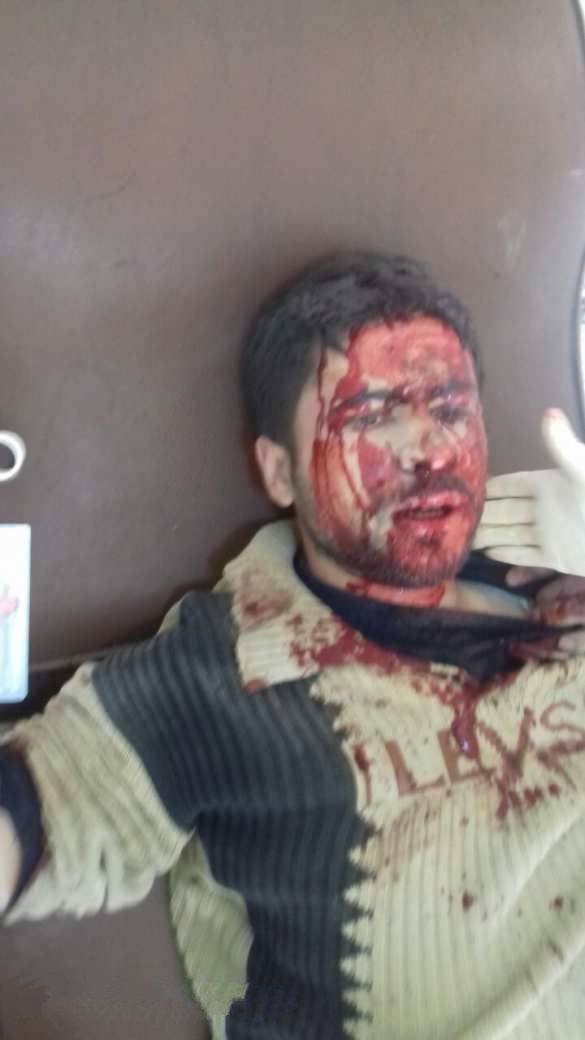 «Ан-Нусра» штурмует жилой квартал в Алеппо, боевики вклинились в оборону YPG на 300 м «Ан-Нусра» штурмует жилой квартал в Алеппо, боевики вклинились в оборону YPG на 300 м