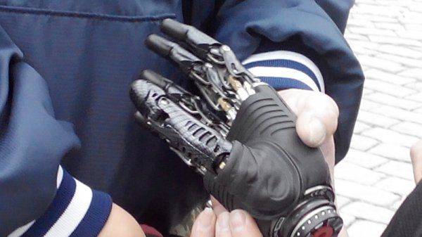 Cапер Гельмут вернется в строй. Деньги на «кибер-кисть» собраны Cапер Гельмут вернется в строй. Деньги на «кибер-кисть» собраны