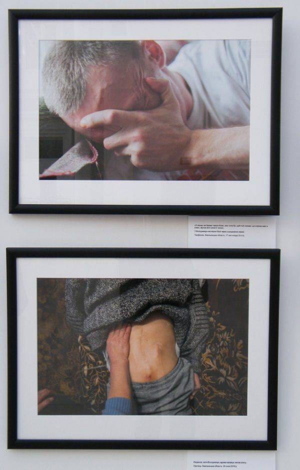«Я назвал свой нерв Путиным – он меня мучает постоянно» – в Киеве открылась выставка фото искалеченных солдат АТО  «Я назвал свой нерв Путиным – он меня мучает постоянно» – в Киеве открылась выставка фото искалеченных солдат АТО
