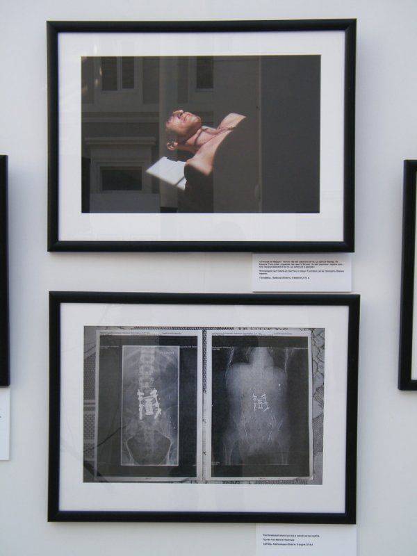 «Я назвал свой нерв Путиным – он меня мучает постоянно» – в Киеве открылась выставка фото искалеченных солдат АТО  «Я назвал свой нерв Путиным – он меня мучает постоянно» – в Киеве открылась выставка фото искалеченных солдат АТО