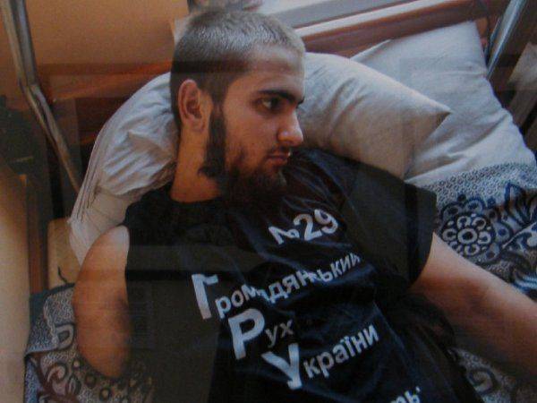 «Я назвал свой нерв Путиным – он меня мучает постоянно» – в Киеве открылась выставка фото искалеченных солдат АТО  «Я назвал свой нерв Путиным – он меня мучает постоянно» – в Киеве открылась выставка фото искалеченных солдат АТО