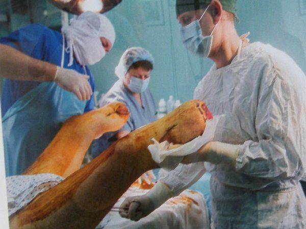 «Я назвал свой нерв Путиным – он меня мучает постоянно» – в Киеве открылась выставка фото искалеченных солдат АТО  «Я назвал свой нерв Путиным – он меня мучает постоянно» – в Киеве открылась выставка фото искалеченных солдат АТО