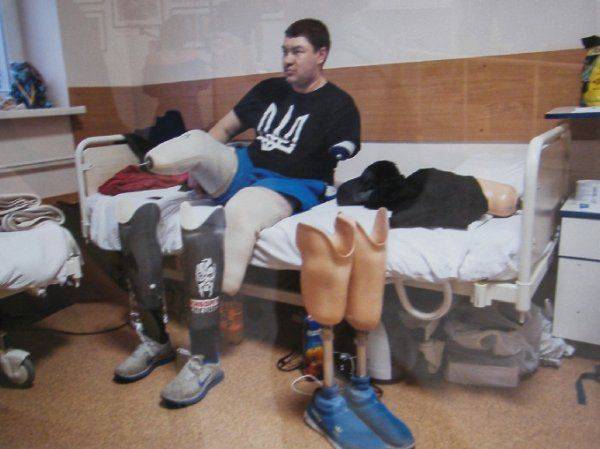 «Я назвал свой нерв Путиным – он меня мучает постоянно» – в Киеве открылась выставка фото искалеченных солдат АТО  «Я назвал свой нерв Путиным – он меня мучает постоянно» – в Киеве открылась выставка фото искалеченных солдат АТО