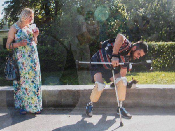 «Я назвал свой нерв Путиным – он меня мучает постоянно» – в Киеве открылась выставка фото искалеченных солдат АТО  «Я назвал свой нерв Путиным – он меня мучает постоянно» – в Киеве открылась выставка фото искалеченных солдат АТО