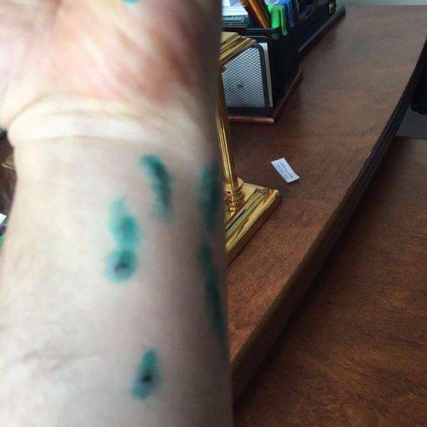 Вилкулу грозит курс уколов от бешенства – Парасюк прокусил ему руку  Вилкулу грозит курс уколов от бешенства – Парасюк прокусил ему руку