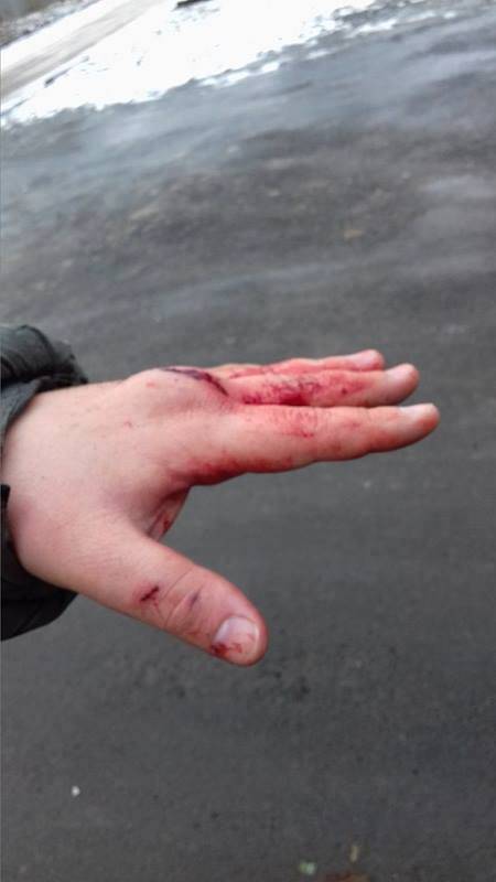 В Харькове в очередной раз надавали тумаков активисту майдана В Харькове в очередной раз надавали тумаков активисту майдана