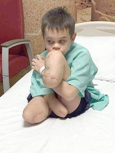 Донбасского мальчика без ног и руки, искалеченного украинскими карателями, заставили отжиматься в их поддержку Донбасского мальчика без ног и руки, искалеченного украинскими карателями, заставили отжиматься в их поддержку