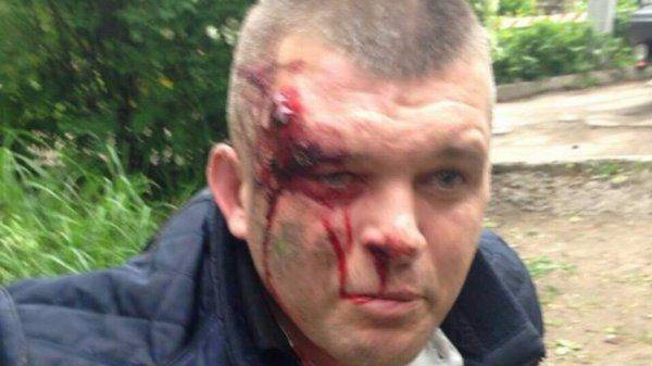 Бойня охранников Яроша с таксистами Каменского. Реконструкция событий на родине "провідника" Бойня охранников Яроша с таксистами Каменского. Реконструкция событий на родине "провідника"