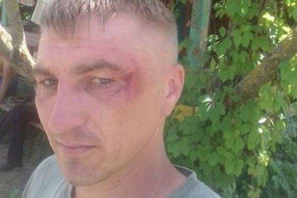 Подбитые «чайки»: на территории детского лагеря в Лазурном избили ветеранов АТО Подбитые «чайки»: на территории детского лагеря в Лазурном избили ветеранов АТО