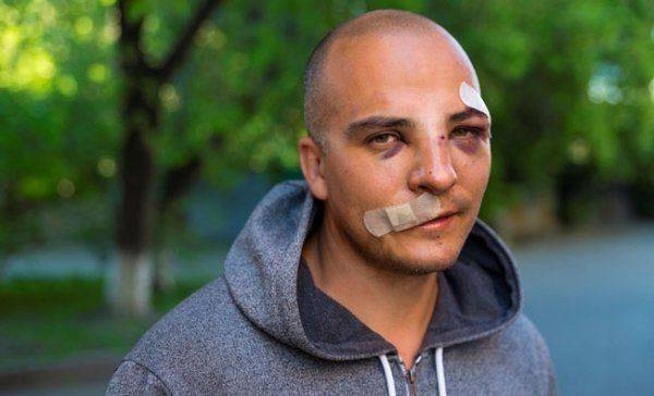 Правозащита - бизнес, Навальный – бренд, а проблемы активистов - частности Правозащита - бизнес, Навальный – бренд, а проблемы активистов - частности