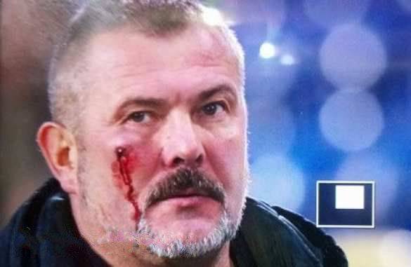 Майданутого «атошника» и нардепа Березу фанаты «Днепра» избили прямо во время футбольного матча Майданутого «атошника» и нардепа Березу фанаты «Днепра» избили прямо во время футбольного матча