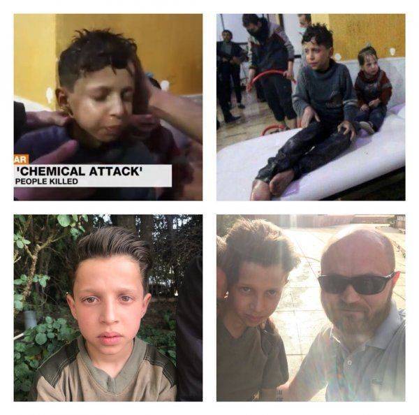 «Убитый химатакой Асада» мальчик рассказал подробности провокации «Убитый химатакой Асада» мальчик рассказал подробности провокации