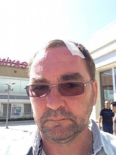 Украинцы мочат "клятых москалей" уже и в Баку. Видимо они, украинцы,чем-то всё-таки инфицированы.