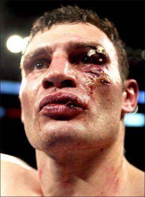 Украина: состояние аффекта