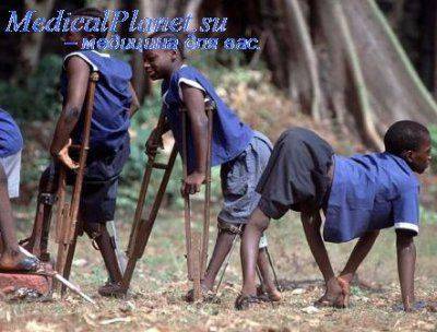 ВОЗ опасается вспышки полиомиелита на Украине