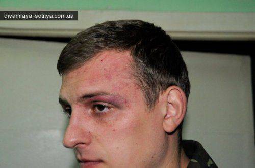 Полк «АЗОВ» изувечил и ограбил трех наблюдателей от «ЛЕВОГО БЕРЕГА»