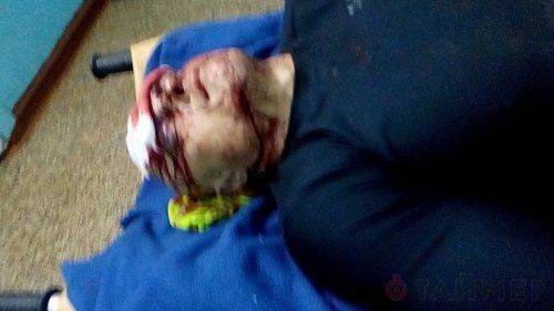 «Евромайдановцы» сообщают о жестоком нападении на своего товарища и обещают мстить