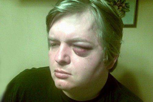 В Харькове жестоко избили активиста Евромайдана