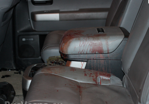 «Я всех прощаю», — А. Мозговой после перевязки вернулся к обязанностям и рассказал о покушении