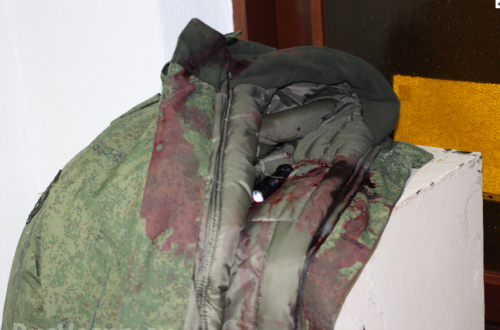 «Я всех прощаю», — А. Мозговой после перевязки вернулся к обязанностям и рассказал о покушении