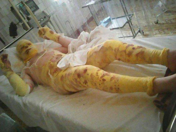 Французские СМИ: «Пушечное мясо» Порошенко на грани исчезновения  