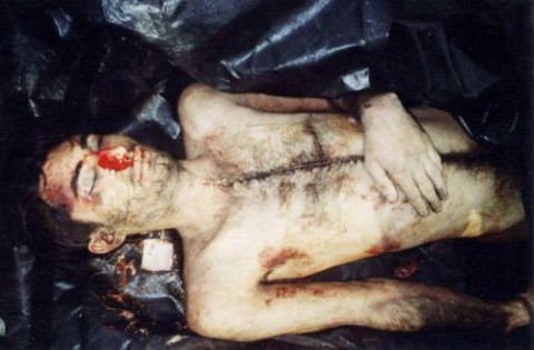 Саакашвили и торговля органами погибших и раненых в зоне «АТО» 