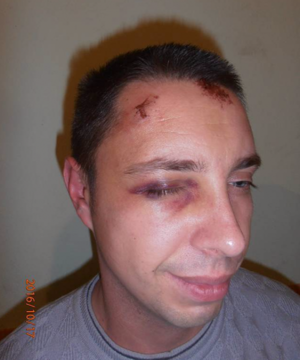 Пьяных в дым начальников СБУ и ВСУ избили и задержали батальонщики под Мариуполем