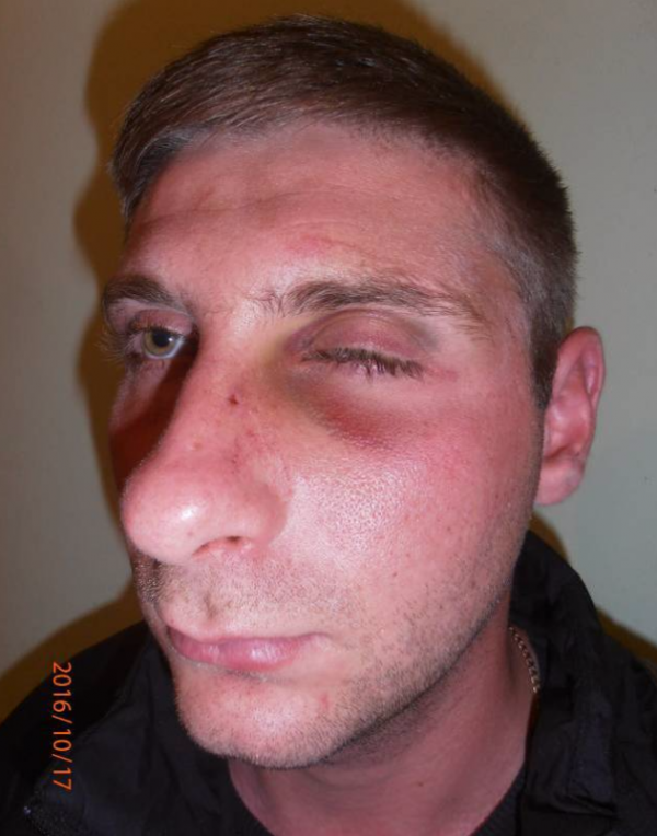 Пьяных в дым начальников СБУ и ВСУ избили и задержали батальонщики под Мариуполем