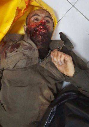 Жестокие бои в Алеппо: Турки и курды убивают друг друга