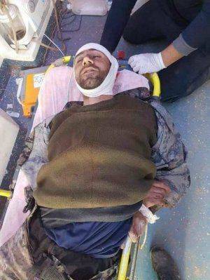 Жестокие бои в Алеппо: Турки и курды убивают друг друга