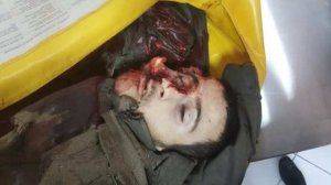 Жестокие бои в Алеппо: Турки и курды убивают друг друга