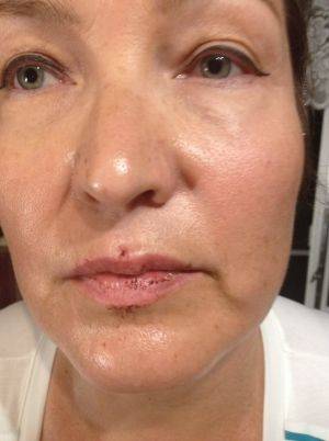 «Почему люди такие злые? Я их на востоке защищал!» Атошник удивлен, что его избивают соседи