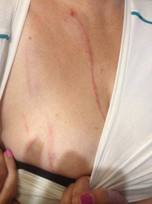 «Почему люди такие злые? Я их на востоке защищал!» Атошник удивлен, что его избивают соседи