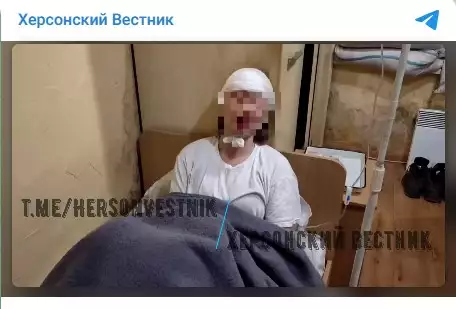 Русские БПЛА пощадили женщину-бойца на передовой